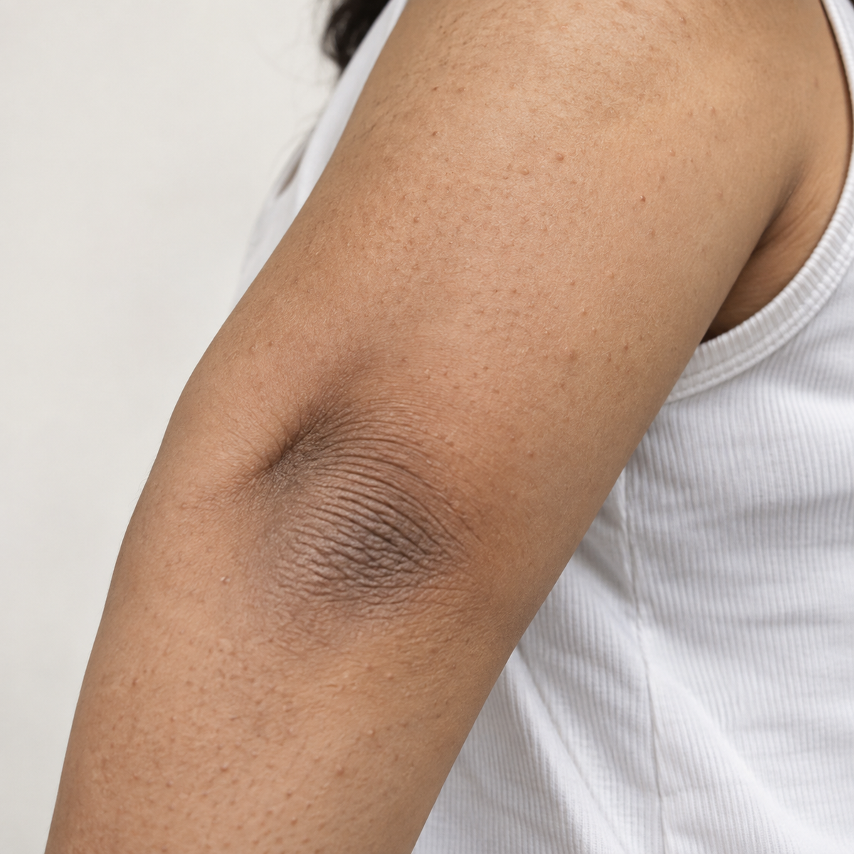 Before exfoliation skin appearance