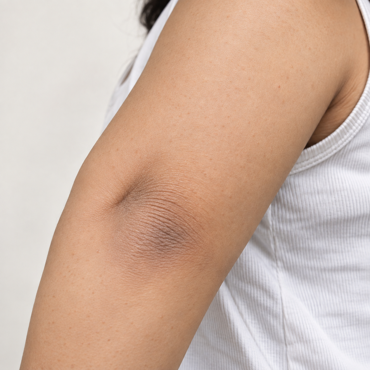 After exfoliation skin appearance